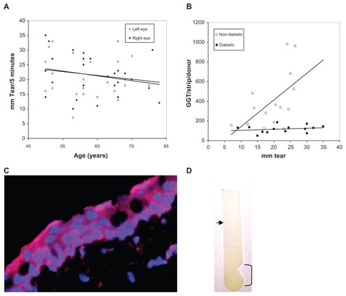 Figure 5 (A) Scatter graph plot of the bilateral Schirmer tear production of all adult donors versus age showing a general decline in tear production (left and right trend lines) with donor age. (B) Scatter graph plot with trend line (linear regression) of tear volume (mm) per Schirmer test strip versus GGT activity per Schirmer test strip for non-diabetic and diabetic tear donors. (C) Distribution of GGT (red) on DAPI-stained (blue nuclei) human conjunctival epithelial cells (×400). (D) GGT reaction substrate (yellow color) was concentrated on the Schirmer’s test strip in the conjunctival contact area (bracket) and decreased toward the tear meniscus (arrow).