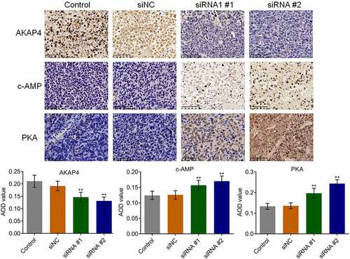 Figure 6. The c-AMP/PKA signaling in tumor tissues was activated by the knockdown of AKAP4. The expression level of AKAP4, c-AMP, and PKA was determined by immunohistochemical assay (**p < 0.01 vs. siNC). The controls were nude mice planted with H460 cells incubated with blank completed medium.