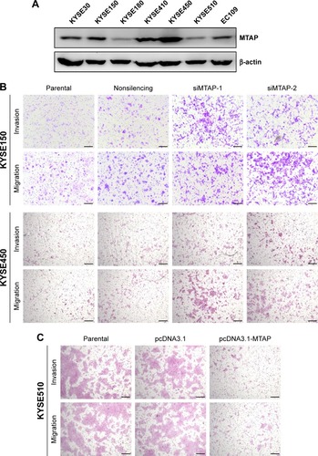 Figure 3 MTAP knockdown increased the motility of ESCC cells.