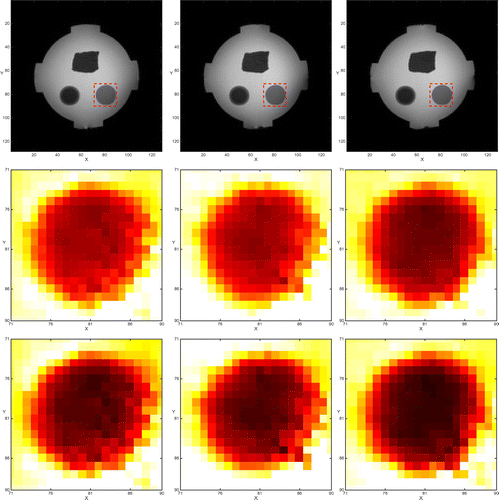 Figure 19. Magnified images of the agar regions of the phantom. The top row provides MR images with region of interest. The middle row shows the reconstructed conductivity images without considering the influence of Jz component. The bottom row shows the reconstructed conductivity images using the two-step algorithm considering the influence of Jz component.