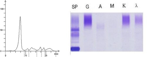 Figure 3. The results of the first serum protein electrophoresis and immunofixation electrophoresis (January 8, 2021). The serum protein electrophoresis in our hospital showed no M protein. Immunofixation electrophoresis + immunoglobulin light chain quantification: no obvious clonal bands were observed.