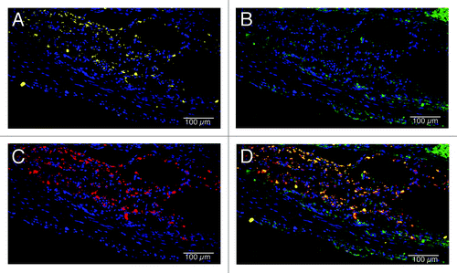 Figure 12. Macrophage phenotype analysis of UBM patches at 4 weeks after surgery. A mixed M1/M2 response was observed in the patches. Macrophages were primarily localized to the inner half of the patches, with a concentration near the interface with native tissue. (A) M1 macrophages (CD86, yellow; draq5, blue), (B) M2 macrophages (CD206, green; draq5, blue), (C) pan-macrophage (CD68, red; draq5, blue), (D) combined image. Scale indicates 100 µm.
