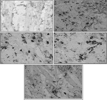 Figure 7. Representative photomicrographs of ventricular tissue stained for nick-end labeling (TUNEL) for DNA breaks from different experimental groups. TUNEL-positive nuclei are staining seen as brown to black nuclei. (A) Healthy control rats, showing no TUNEL-positive cells; (B) ISP-treated control rats, showing TUNEL-positive cells; (C) HETA-treated rats, reduced TUNEL positivity relative to ISP-treated controls; (D) α-tocopherol-treated rats, showing reduction in TUNEL positivity relative to ISP-treated controls; (D) HETA + α-tocopherol-treated rats showing maximum reduction in TUNEL positive myocytes relative to ISP-treated controls.