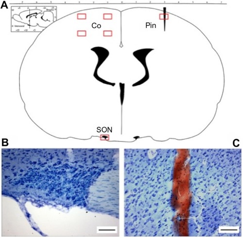 Figure 1 ROIs used in quantitative analysis of DNs in coronal sections of the rat brain.