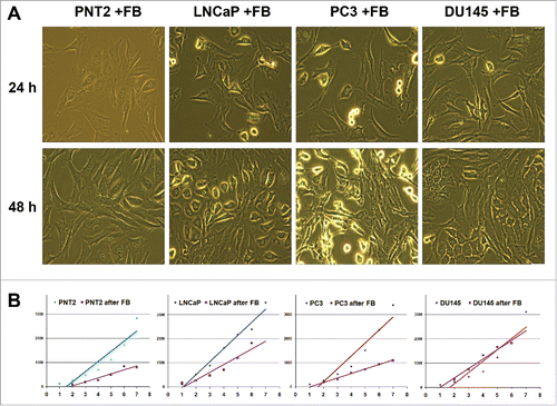 Figure 1. Effects of BJhTERT fibroblasts on proliferation of normal and cancer prostate epithelial cells in vitro. (A) Morphology of cocultures at day 1 and day 2 (light microscopy), magnification ×200. (B) Proliferation rates of normal (PNT2) and cancer epithelial prostate cells before and after coculture with fibroblasts (CyQUANT NF Cell proliferation assay).