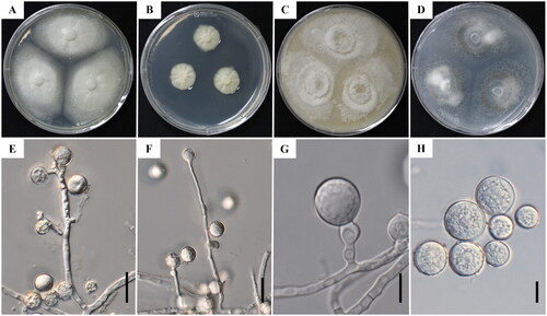 Figure 1. Cultural and morphological characteristics of Botryotrichum luteum (KNUF-22-025T). Colonies on potato dextrose agar (A), malt extract agar (B), oatmeal agar (C), and potato carrot agar (D), after 14 days incubation at 25 °C. Conidiophores and conidiogenous cells (E-G); Conidia (H). Scale bars: E, F = 20 µm; G, H = 10 µm.