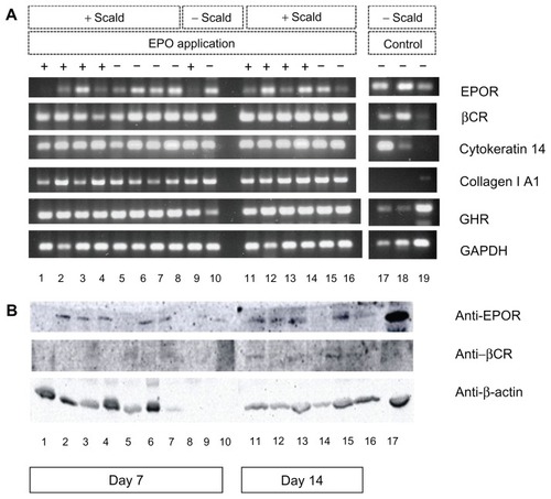 Figure 4 Analysis of gene and protein expression of EPOR, βCR, and growth hormone receptor. (A) Reverse transcriptase polymerase chain reaction analysis of gene expression of EPOR, βCR, and growth hormone receptor, and characteristic markers of scalded mouse skin tissue samples on days 7 and 14 after injury and continuous application of rhEPO or its vehicle (control) by subcutaneous injection. DNA bands 1–4 scalded mice of EPO group (+EPO) on day 7; bands 5–8, scalded mice of control group (−EPO, vehicle) on day 7; band 9, nonscalded mouse with EPO application (control); band 10, nonscalded mouse without EPO application (control) on day 7; bands 11–14, scalded mice of EPO group (+EPO) on day 14; bands 15–16, scalded mice of control group (−EPO, vehicle) on day 14; bands 17–19, three additional tissues as comparable controls; band 17, skin nonscalded control; band 18, spleen nonscalded control; band 19, kidney nonscalded control. Polymerase chain reaction products for EPOR, βCR, and other markers were visualized on 1.5% agarose gel with ethidium bromide. (B) Western blot analysis of protein expression of EPOR, βCR, and growth hormone receptor of scalded skin tissue samples of mice on days 7 and 14 after injury and continuous application of rhEPO or its vehicle (control) by subcutaneous injection. Bands 1–4, mice of EPO group (+EPO) on day 7; bands 5–8, mice of control group (EPO, vehicle) on day 7; band 9, nonscalded mouse with EPO application (control); band 10, nonscalded mouse without EPO application (control) on day 7; bands 11–14, mice of EPO group (+EPO) on day 14; bands 15–16, mice of control group (−EPO, vehicle) on day 14; band 17, additional mouse liver tissue as nonscalded comparable control (−EPO). β-actin was used as loading control.Abbreviations: EPO, erythropoietin; rhEPO, recombinant human erythropoietin; EPOR, erythropoietin receptor; βCR, common β subunit receptor.