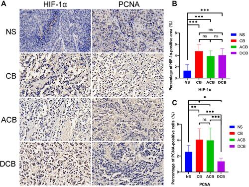 Figure 4 (A) Representative pictures of tumor HIF-1α and PCNA immunohistochemistry (400×); (B) quantitative analysis of HIF-1α positive results; (C) quantitative analysis of PCNA positive results. *P<0.05; **p<0.01; ***P<0.001.