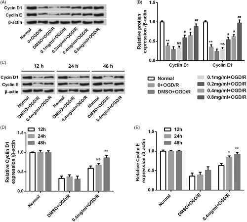 Figure 5. SBD altered the expression of proliferation-related proteins in PC12 cells after OGD/R injury. (A and B) PC12 cells were pretreated with different concentrations of SBD (0.1–0.8 mg/ml) for 24 h and then were subjected to OGD/R injury. The expression levels of proliferation-related proteins were assessed using western blot. **p < .01 compared to Normal group. NS: no significant; #p < .05; ##p < .01 compared to DMSO + OGD/R group. (C–E) PC12 cells were pretreated with 0.4 mg/ml SBD for different times (12, 24 and 48 h), and then subjected to OGD/R injury. Western blot was performed to assess the expression levels of proliferation-related proteins. NS: no significant; *p < .05; **p < .01 compared to 12 h. Data presented as mean ± SD (n = 3).