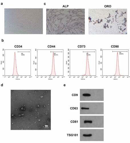 Figure 5. Identification of BMSCs and Exo.