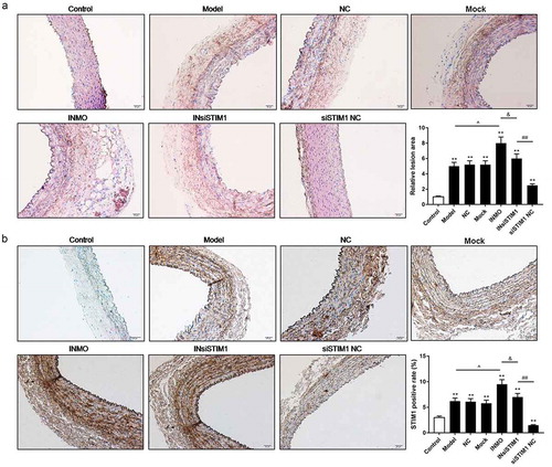 Figure 7. Inhibition of miR-185 augmented atherosclerosis by targeting STIM1 in vivo. (a) The lesions of arterial wall tissues were detected by HE staining assay. (b) STIM1 positive rate was measured by IHC assay. *P< 0.05, **P< 0.01, versus control. ^P< 0.05, ^^P< 0.01, versus mock. &P< 0.05, versus INMO. #P< 0.05, ##P< 0.01, versus INsiSTIM1.