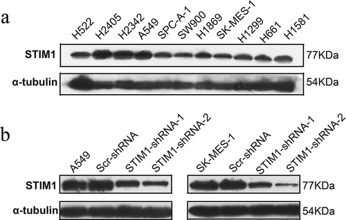 Figure 2. Expression and knockdown of STIM1 expression in NSCLC cell lines. (a) The expressiom of STIM1 in 11 NSCLC cell lines were detected by Western blotting. (b) and (c) Western blotting analysis of STIM1 expression in A549 and SK-MES-1 cells infected with STIM1 shRNA lentivirus. α-Tubulin as used as a loading control. STIM1, stromal interaction molecule 1; NSCLC, non-small-cell lung cancer.