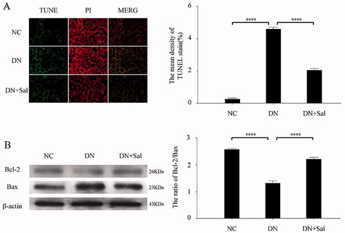 Figure 3. Effects of salidroside on apoptosis of the kidney from the rats with streptozotocin-induced DN. (A) TUNEL (green) and PI (red) staining was performed in the DN, DN + SAL, and NC groups. The TUNEL-positive stromal area quantification was shown by histogram. (B) Western blot analysis for the expression of Bcl-2 and Bax in kidney tissue and quantification of the Bcl-2/Bax levels. ****p < 0.0001. DN: diabetic nephropathy; DN + SAL: rats with DN treated with salidroside; NC: normal control; TUNEL: terminal dUTP nick-end labelling.