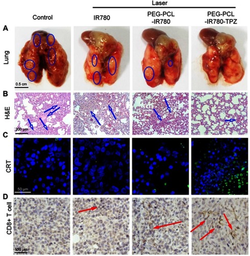 Figure 9 (A) Representative lung images showed the metastatic lesions in different treatment groups. The blue circles represented metastatic lesions on lung. Scale bars: 0.5 cm. (B) H&E staining for lung tissues of different treatment groups. Blue arrows indicate apoptosis and necrosis. Scale bars: 200 μm. (C) Ex vivo immunofluorescence indicated the level of CRT expression in primary tumor tissues. The green area indicated CRT while the blue area indicated cell nuclei. Scale bars: 50 μm. (D) The activated CD8+ T-cell infiltrated into tumor tissues after treating with different treatments. The red arrow represented the CD8+ T-cells. Scale bars: 100 μm.Abbreviations: PEG-PCL-IR780-TPZ NPs, polyethylene glycol- polycaprolactone-2-[2-[2-Chloro-3-[(1,3-dihydro-3,3-dimethyl-1-propyl-2H-indol-2-ylidene)ethylidene]-1-cycloxen-1-yl]-ethenyl]-3,3-dimethy-1-propyl-1H-indolium iodide-tirapazamine nanoparticles; CRT, calreticulin.