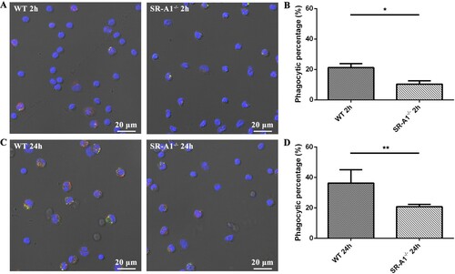 Figure 4. SR-A1-/- PMs were deficient in phagocytosis of L. interrogans strain 56606v in vivo. WT or SR-A1-/- mice were infected by IP injection of 2 × 108 bacteria per mouse. PMs were harvested at 2 and 24 hpi, respectively. Rabbit anti-L. interrogans strain 56606v was used as a specific primary antibody, while FITC-conjugated or TRITC-conjugated anti-rabbit IgG as a secondary antibody were used before and after permeabilization, respectively. Confocal microscopic images showed leptospires inside (red) or outside (yellow) of PMs at 2 hpi (A) and 24 hpi (C). Phagocytic percentages were calculated and statistically analysed (B, D). These data were expressed as the mean ± SEM from at least three experiments. **P < 0.01.