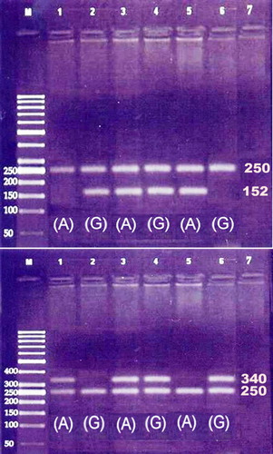 Figure 1. Amplification of FVL (above) and FII (down) using primers for mutant A alleles (lanes 1, 3, and 5) and normal G allele (lanes 2, 4, and 6) showing positive bands of size 152 bp for FVL and 340 bp for FII, whereas the 250 bp band corresponds to amplified segment of FIX serving as internal control. Lane M corresponds to DNA size marker and lane 7 to the negative control.