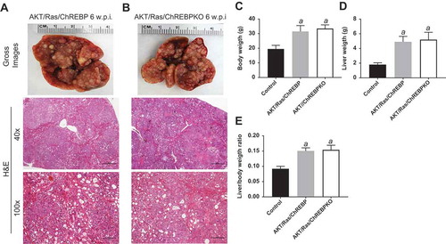 Figure 6. Genetic ablation of ChREBP in the mouse liver does not affect tumor development driven by AKT/Ras co-expression. (a,b) Overexpression of AKT/Ras triggered the development of multiple hepatocellular carcinomas and cholangiocarcinomas both in ChREBP WT (AKT/Ras/ChREBP; n = 20) and ChREBP KO (AKT/Ras/ChREBPKO; n = 20) mice. Tumors in the two mouse cohorts developed with the same latency and were indistinguishable histopathologically (a,b) as well as in body weight (c), liver weight (d), and liver/body weight ratio (e). Original magnifications: 40x and 100x. Scale bar: 500µm for 40x, 100µm for 100x. Abbreviations: HE, hematoxylin and eosin staining; w.p.i, weeks post injection. Tukey–Kramer test: P < 0.0001 a, vs control (mice injected with empty vector).