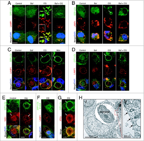 Figure 2. Chloroquine and monensin induce LC3 lipidation onto multiple lysosomal compartments dependent on V-ATPase activity. (A and B) Confocal images of GFP-LC3 and LAMP1 immunostaining of (A) lysosomes in MCF10A and (B) uncoated latex bead phagosomes in J774 macrophage following treatment with Baf (100 nM), CQ (100 mM) or Baf + CQ for 1 h. Arrow indicates GFP-LC3 lipidation onto a phagosome. Bar = 6 μm. (C and D) Images of GFP-LC3 and LAMP1 on entotic corpse vacuoles in MCF10A cells treated with Baf, CQ, Mon (100 μM) or Baf + CQ for 1 h. Arrows indicate GFP-LC3 lipidation onto vacuoles. Bar = 10 mm. (E) GFP-LC3 and ATP6V0D1 (V0D1) staining on entotic corpse vacuoles with our without CQ treatment. Bar = 10 μm. (F) GFP-LC3G120A and LAMP1 staining on entotic corpse vacuoles following CQ treatment. Bar = 10 μm. (G) GFP-LC3 and ATG5 immunostaining on entotic corpse vacuole (arrows) following CQ treatment. Bar = 10 μM. (H) (i) Electron microscopy of corpse containing cell-in-cell structure treated with CQ (100 μM), (ii) entotic corpse vacuole has a single membrane (arrows). See also Figure S3; Movie S1.