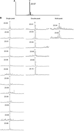 Figure 2 (A) Signal curve on the summary display of the IOLMaster® (version 5.4; Carl Zeiss AG, Oberkochen, Germany). (B) Each signal curve of PCI measurements. The circles indicate the highest peaks of the curve, which are used for calculating axial length. The arrows indicate the second highest peaks, which are one of the components of the double peak.