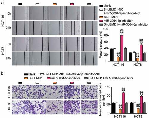 Figure 9. MiR-3064-5p repressed cell migration and invasion by inhibiting LEMD1