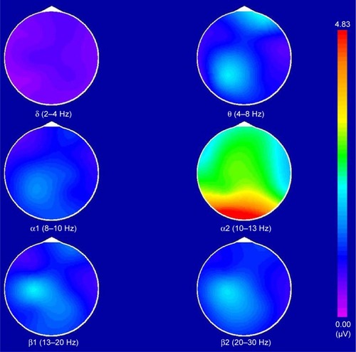 Figure 1 The brain electrical activity mapping (BEAM) of healthy controls.