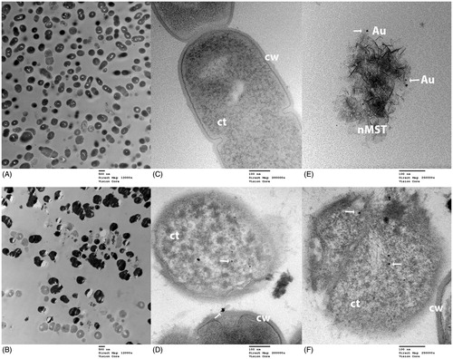 Figure 8. TEM images of S. mutans (Sm) and nMST-Au(III) (A) and (C) untreated Sm images taken at magnification 12,000× and 120,000×, respectively. Bacterial cell wall (cw) and cytoplasm (ct) were marked. (B) and (D) Sm with nMST-Au(III) images taken at magnification 12,000× and 120,000×, respectively: arrows point to the nanoparticles (NPs) attached to bacterial cell wall (cw) and internalized into bacterial cytoplasm (ct) (E) arrows point to gold (Au) NPs in nMST compared in size, shape and density with (F) arrows pointing to NPs in partial rupture of Sm cell with nMST-Au(III). Image taken at magnification 250,000×.