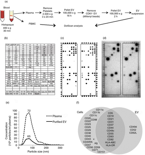 Fig. 3.  Workflow for preparation of PBMC and CD61-depleted EV from blood (a), with DotScan profiling (b–d). The key (b) shows antibody locations, with shaded antibodies indicating cell capture. DotScan analyses are shown for 3×106 PBMC (c) and CD61-depleted EV from 10 ml of blood (d) from an 87-year-old female CLL patient (Patient 1) with a white blood cell count of 45.3 x109/L. EV were tested in the presence of heat inactivated human AB serum (2%). Detection of captured cells was by optical scanning (c). EV were detected by ECL using biotinylated CD19 antibody, with a 30 min exposure on ECL film (d). NanoSight analysis (e) compares the average size distributions (tested in triplicate) of EV in the plasma and purified CD61-depleted EV from the plasma. The results are shown as average number of particles per ml of plasma before and after enrichment for CD61-depleted EV; the numbers above the peaks represent mode sizes in nm. A Venn diagram (f) compares surface profiles of patient CLL cells and their EV.