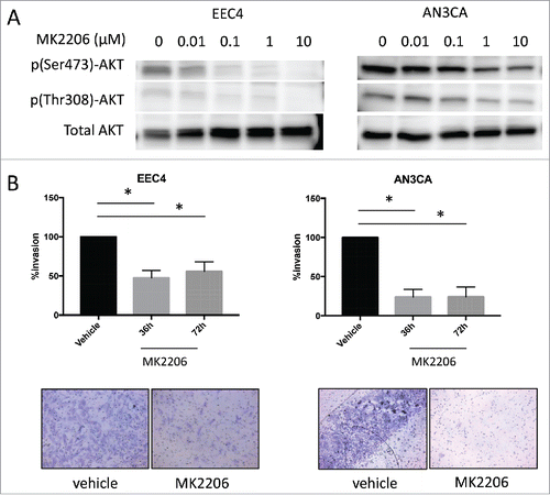 Figure 4. Effect of MK2206 on EEC4 and AN3CA cells in vitro. (A) Cells from EEC4 and AN3CA were cultured in vitro and treated with increasing concentrations of MK2206 (0, 0.01uM, 0.1uM, 1uM, 10uM). Levels of p(Ser473)-AKT, p(Thr308)-AKT and pan AKT were measured by western blot. (B) EEC4 and AN3CA were plated on matrigel coated membranes and treated with 1uM MK2206 for 36h and 72h. Cells on top were scraped off and cells that invaded through to the underside of the membrane was visualized with Diff-Quik stain. Invading cells were visualized under light microscopy and representative pictures are shown of cells treated with 1uM MK2206 for 72h (magnification 200X). The number of invading cells was counted in 4 different fields using ImageJ and the average was taken. Data was log transformed for statistical analysis. Data are presented as percent changes of MK2206 treated compared with vehicle treated cells. (* denotes statistical significance, p < 0.05).