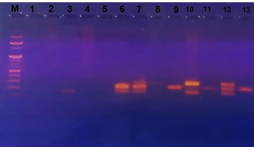 Figure 1 Detection of UPEC phylogroups using multiplex PCRCitation11 targeting the genes chuA (279bp) and yjaA (211bp) and the DNA fragment TspE4.C2 (154bp). Lane M: 100 bp DNA Ladder. Lane 1: Distilled water as negative control, Lane 2: phylogroup A, Lane 3: phylogroup B1, Lane 4,5: phylogroup A, Lane 6: phylogroup B1, Lane 7: phylogroup B2, Lane 8: phylogroup A, Lane 9: phylogroup A, Lane 10: phylogroup D, Lane 11: phylogroup A, Lane 12: phylogroup B2 and Lane 13: phylogroup A.