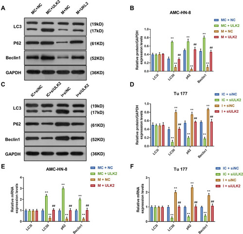 Figure 11 Overexpression of ULK2 rescued the inhibitory effects of miR-26a-5p mimic on AMC-HN-8 cells autophagy. The protein expressions of LC3I, LC3II, Beclin1 and p62 in AMC-HN-8 cells were determined (A) and quantified (B) by Western blot. The protein expressions of LC3I, LC3II, Beclin1 and p62 in Tu 177 cells were determined (C) and quantified (D) by Western blot. (E) The mRNA levels of LC3I, LC3II, Beclin1 and p62 in AMC-HN-8 cells were determined by qRT-PCR. (F) The mRNA levels of LC3I, LC3II, Beclin1 and p62 in Tu 177 cells were determined by qRT-PCR. **P<0.01 vs MC+NC or IC+siNC, ##P<0.01 vs M+NC or I+siNC.