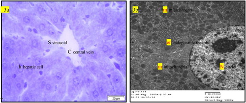 Figure 3. (a) Light micrograph of semi thin section of liver of normal rats (GI) showing the normal morphological structure of the hepatic lobule, hepatic cells (h), sinusoids (S) and central vein (C). T.B. stain. (b) T.E. micrograph of hepatic cell of normal rats (GI) showing large vesicular nucleus (N), rough endoplasmic reticulum RER (er), mitochondria (m).