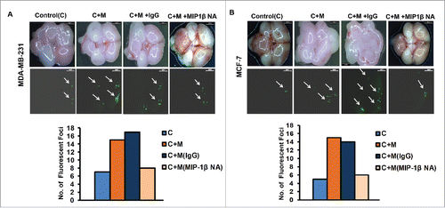 Figure 5. Blockade of MIP-1β function minimized ex ovo dissemination of co-cultured cancer cells from chick chorioallantoic memebrane to chik brain. (A and B) Representatitive results of ex ovo chick chorioallantoic membrane assay for spontaneous metastasis. MIP-1β-neutralizing antibody (MIP-1β NA) mediated in vivo functional blockade of MIP-1β-impeded spontaneous metastasis of co-cultured (with macrophages) breast cancer cells [C + M + MIP-1β NA] compare to cells that were not treated with MIP-1β NA [C + M + IgG and C + M] from chicken chorioallantoic membrane to chicken brain. Bars represent number of fluorescent foci in each group. All the experiments were done in triplicates and repeated at least thrice. Abbreviations—C: Respective cancer cells; C + M: Respective cancer cells co-cultured with macrophages; C + M(IgG): Respective cancer cells co-cultured with macrophages treated with isotype antibody control IgG; C + M + MIP-1β NA: Respective cancer cells co-cultured with macrophages treated with MIP-1β-neutralizing antibody.