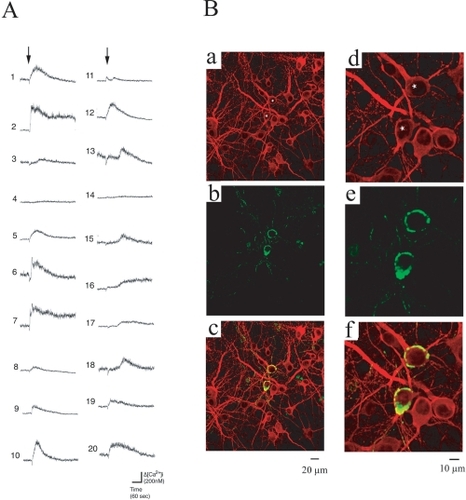 Figure 2 Heterogenic responses to AβP. A. Patterns of [Ca2+]i increase in 20 hippocampal neurons induced by AβP[1–40]. Traces of temporal changes in [Ca2+]i in 20 randomly chosen cultured hippocampal neurons in the same field of view were analyzed. Numbers represent the number of cells used in the analysis. Arrows indicate the time at which 10 μM AβP[1–40] was added to the bath solution. B. Immunohistochemical identification and localization of AβP[1–40] on cultured hippocampal neurons. Laser confocal microscopy images of cultured hippocampal neurons (29 DIV) after MAP2 binding (Texas Red, red) ((a) and (d)) and AβP binding (FITC, green) ((b) and (e)), and their superimposed images ((c) and (f)). Images (d)-(f) are images of the same areas shown in (a)-(c) at a higher magnification.