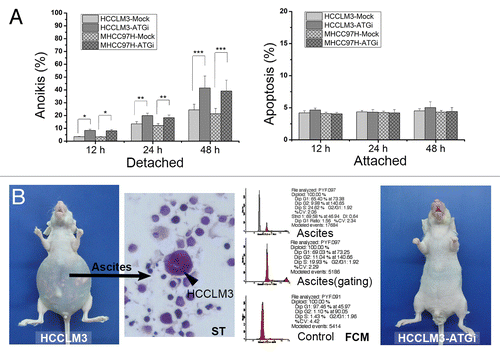 Figure 4. Autophagy inhibition attenuates anoikis resistance of HCC cells via regulation of apoptotic signaling. (A) The in vitro anoikis assay indicated that autophagy inhibition significantly increased the anoikis rate of HCCLM3 cells after cell detachment. (B) In vivo anoikis assays showed that no mice receiving HCCLM3 cells with autophagy inhibition (HCCLM3-ATGi) formed peritoneal metastases and ascites while mice subjected to HCCLM3 cells without autophagy inhibition (HCCLM3) could establish. The HCCLM3 ascites cells were determined by smear test (ST) and flow cytometric DNA analysis (FCM).