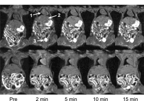 Figure 2 Contrast-enhanced coronal magnetic resonance images of nude mice before (pre) and at various time points after intravenous injection of nanoglobule-G4-cystamine-(Gd-DO3A; top panel) and Gd(DTPA-BMA; lower panel). Arrows point to the heart (1), liver (2), and bladder (3).