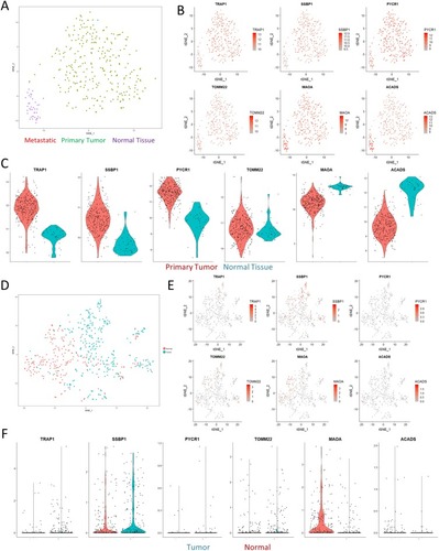 Figure 3 Paired analyses with TCGA and single-cell RNAseq. (A) tSNE visualization of the TCGA colon cancer cohort shows clear separation of normal solid tissue from tumor samples. (B) Overlaid gene expression visualization of the expression profiles of mitochondrial genes identified in Figure 2 shows that the proteomics results we observed could also be matched with larger cohort-level data. (C) Violin plots computing the expression levels between normal and primary tumor samples. All of the visualizations shown were significant at a p-value <0.01 according to Wilcoxian testing. (D) tSNE visualization of a single-cell sequencing dataset of a colorectal cancer sample. (E–F) tSNE visualization and violin plots of the same genes in (B) show similar effects in terms of expression differences, albeit with significant levels of dropout.