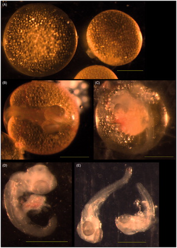 Figure 3. Abnormal embryos of group II guppies exposed to 1.0 mg/l copper sulphate. (A) Blastodisc stage. No blastodisc was observed in the left giant embryo. Blastodisc was visible in the right embryo of normal size. (B) Optic cup stage. Optic cups were too big. (C) Middle-eyed stage. No skin pigmentation was visible. Yolk droplets in the amnion. (D, E) Middle-eyed stage. Dead embryos without yolk sac and amnion. Bar =500 μm