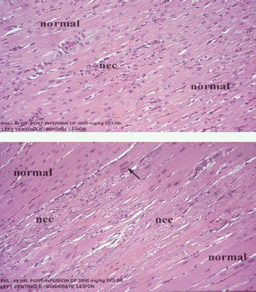 Figure 3. Photomicrographs of H&E stained sections of myocardium from the left ventricle of different swine following infusion of 2000 mg/kg of DCLHb, illustrating typical heart lesions of different severity. (nec = necrosis).