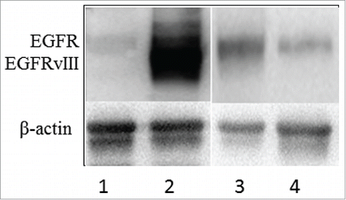 Figure 2. Western blot analysis of EGFR and EGFRvIII protein expression in cultured cells. Lanes 1 and 2 show the U87 and the U87-EGFRvIII cells without and with high expression of EGFRvIII, respectively. Lanes 3 and 4 are JHU-13 and JHU-22 cells as a representative of EGFR expression in head and neck squamous cell carcinoma (HNSCC) cell lines. No EGFRvIII expression was detected in the 6 HNSCC cell lines analyzed.