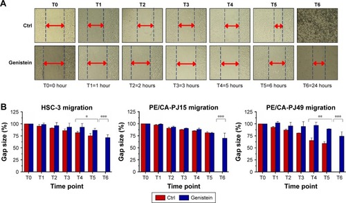 Figure 6 Effects of genistein on cell migration.