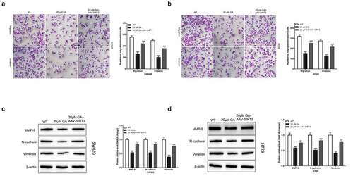 Figure 5. Glycyrrhizic acid inhibits the metastasis of colorectal cancer cells by inhibiting SIRT3 in vitro. (a,b) Transwell chamber was used to assess the invasion and migration ability of SW620 (a) and HT29 (b) cells. (c,d) Western blot analysis of MMP-9, N-cadherin and Vimentin protein expression in SW620 (c) and HT29 (d) cells after stimulating with 0 or 20 μmol/L glycyrrhizic acid for 24 hours. Each test is repeated at least 3 times independently. *** P < 0.001 vs WT group. ## P < 0.01 and ### P < 0.001 vs 20 μM GA group.