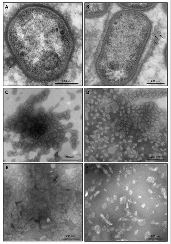 Figure 3. OMV formation by sorting type I and II isolates of P. gingivalis Electron micrographs of vesiculating cells of (A) the P. gingivalis type strain W83, and (B) the sorting type II isolate MDS33. Electron micrographs of OMVs collected from (C) strain W83, (D) the sorting type I isolate 505700, and the sorting type II isolates (E) 505759 and (F) 512915.