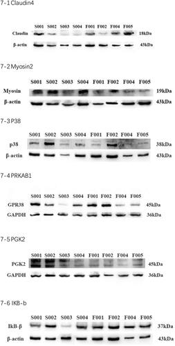Figure 7. Claudin-4, p38, PRKAB, IKB-b, myosin-2, PKG2 were selected for further confirmation by Western blot to validate the data from iTRAQ analysis.