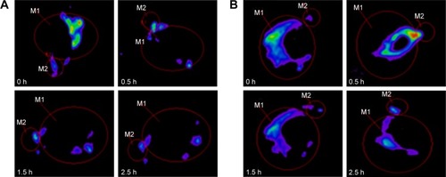 Figure 4 Fluorescence images of rabbit eyes after administration (M1: corneal surface; M2: inner canthus and nasolacrimal duct region).Notes: (A) RhB solution; (B) RhB-CLNs.Abbreviations: CLNs, cationic lipid nanoparticles; RhB, rhodamine B.