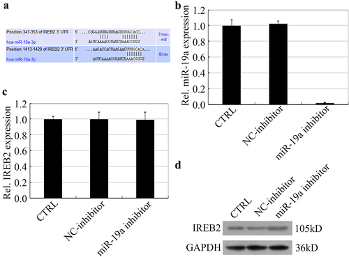 Figure 1. miR-19a inhibits the expression of IREB2 at the translation level. (a) Bioinformatical analysis shows that IREB2 is a target of miR-19a. (B&C) HT29 cells were treated with NC inhibitor or miR-19a inhibitor before harvest, and the mRNA levels of both miR-19a (b) and IREB2 (c) were determined by RT-qPCR. (d) The expression of IREB2 was determined by western blotting in miR-19a inhibitor treatment HT29 cells.