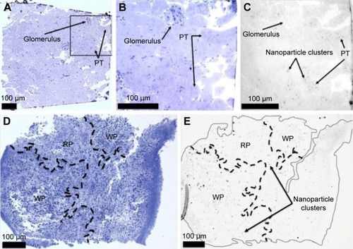 Figure 4 Thick section of mouse injected with TEG particles (A) Kidney stained with toluidine blue, 100×; (B) Kidney stained with toluidine blue, 400×; (C) Kidney, 400×; (D) Spleen stained with toluidine blue, 100×; (E) Spleen, 100×.Abbreviations: TEG, tetraethylene glycol; PT, proximal tubule; RP, red pulp; WP, white pulp.