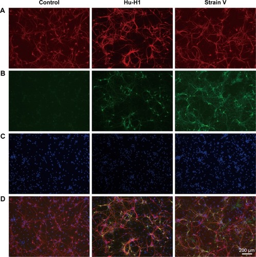 Figure 3 Immunofluorescence analysis of primary hippocampal neurons infected with BDV on day 9 postinfection.