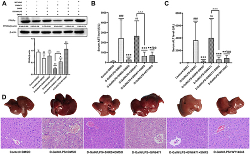Figure 6 SNRS ameliorates liver injury by promoting the expression of PPARα. (A) The expression of PPARα protein in liver tissue of different treatment groups. (B) The serum level of AST. (C) The serum level of ALT. (D) Gross morphology and HE-stained histological section of the liver. #Model group compared with control group, ##P<0.01, ###P<0.001. *Compared to model group, *P<0.05, **P<0.01, ***P<0.001. ΔGW6471 group compared with GW6471+SNRS group, ΔΔΔP<0.05. @SNRS group compared with WY14643 group, @@P<0.01.