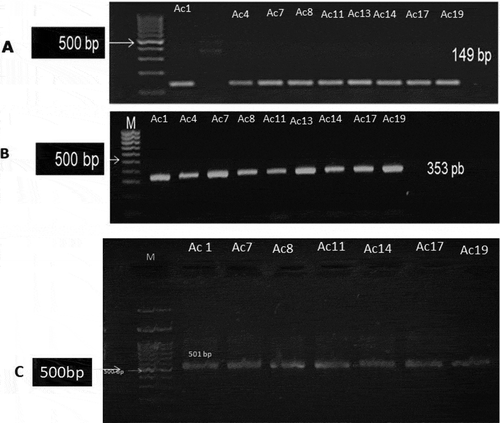 Figure 4. PCR amplicons of Oxa carbapenemase in A. baumannii strains