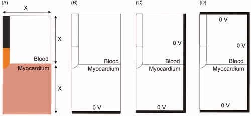 Figure 6. (A) 2D limited-domain model (out of scale) comprised of two fragments: cardiac tissue and blood, both squares of side X (varying between 4 and 8 cm). (B–D) Options to set the electrical boundary condition of 0 V: only on the bottom (B), bottom and side (C), bottom, side and top (D).